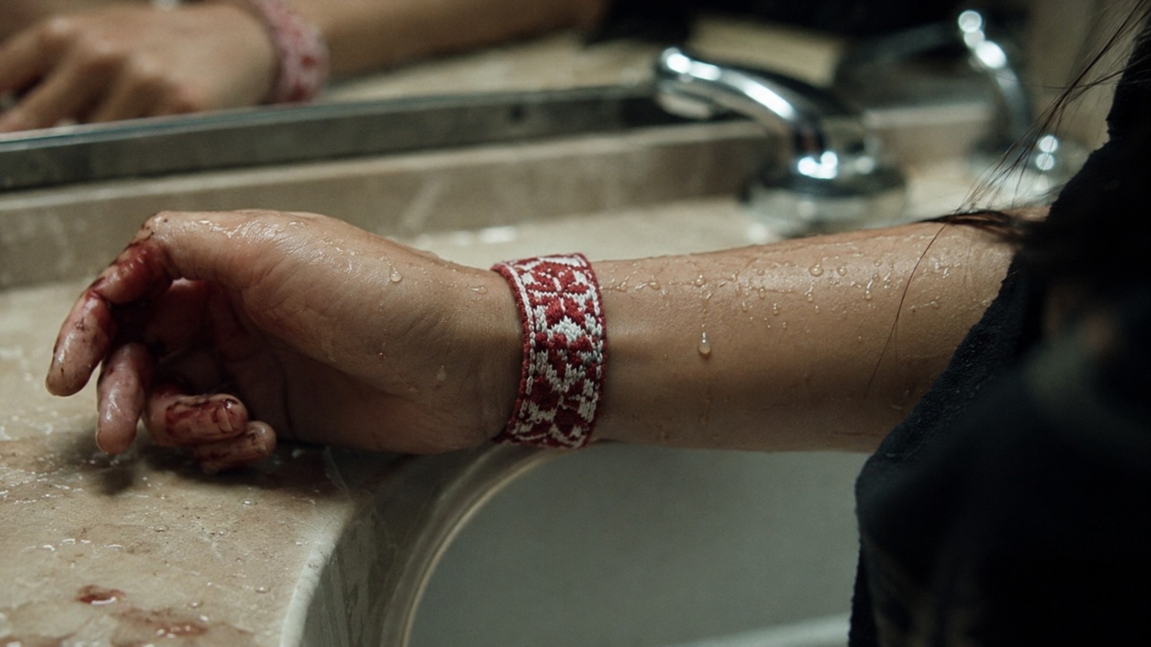 An injured hand wearing a red and white woven bracelet, concept image for the LOST feature